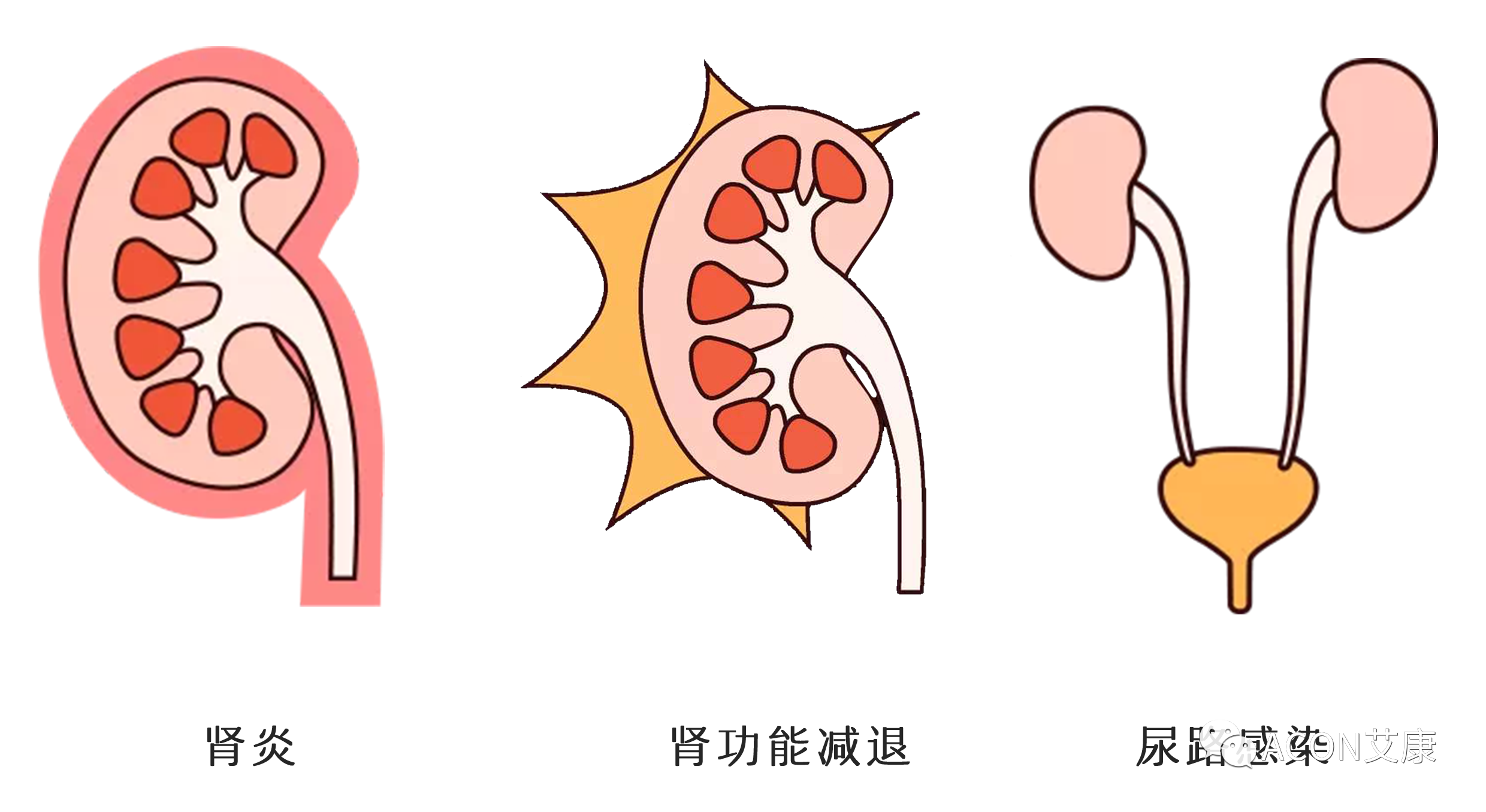 排尿黃、異味大，可能是身體在報(bào)警！